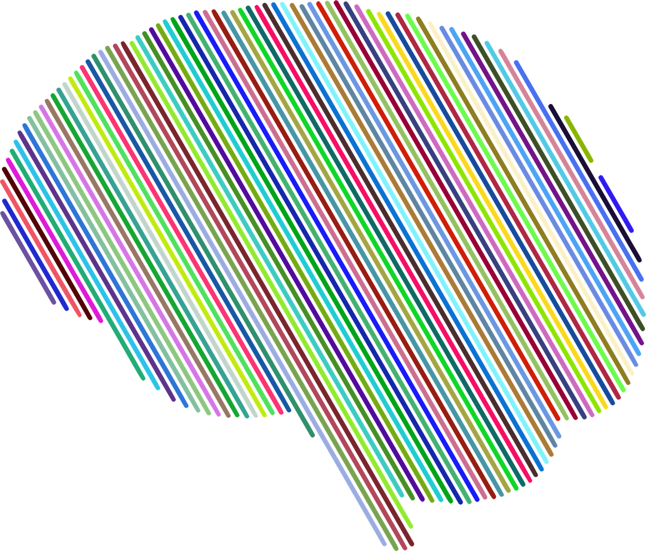 IBM and Pfizer Believe Machine Learning Can Predict Alzheimer’s Risk